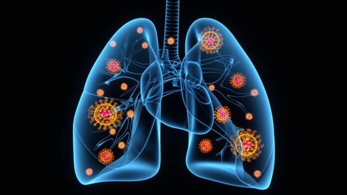 How coronavirus penetrates respiratory cells in the lung