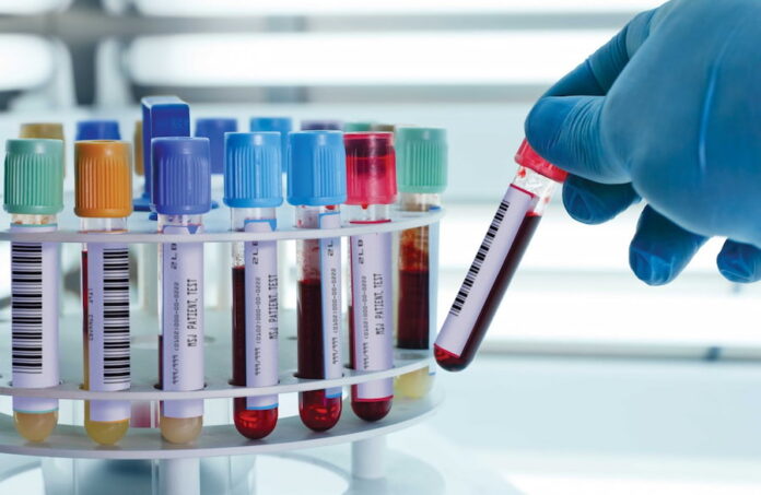 blood sample collection tubes