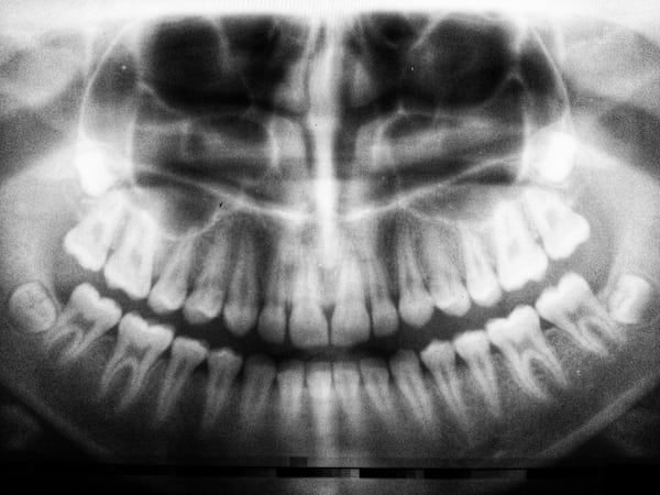 dental panorama xray