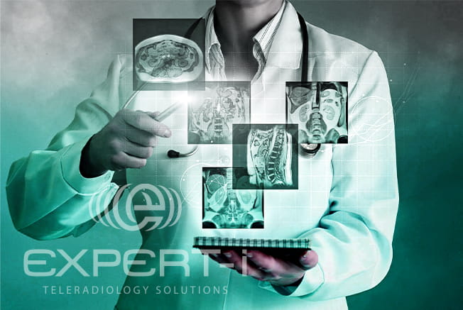 Teleradiology Ai - Expert-i