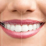 How To Look After Your Dental Health