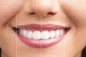 How To Look After Your Dental Health