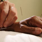 Is Acupuncture Effective? Benefits for Stress & Pain