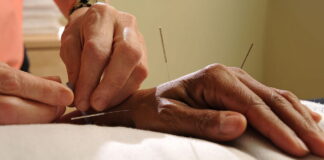 Is Acupuncture Effective? Benefits for Stress & Pain