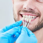 5 Advances That Improve The Look And Feel Of Dental Veneers