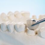 Dental crowns cost