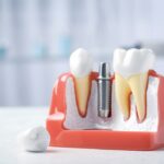 Things To Expect in the Future of Dentistry