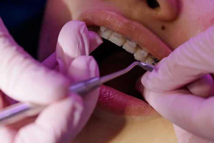 10 Tips For Finding An Orthodontist In Greenville