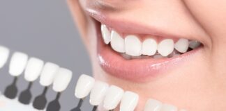 What Are The Differences Between Porcelain Veneers And Composite Veneers