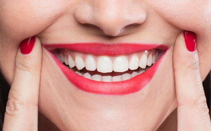 Smile Makeovers and Orthodontics - The Perfect Combination for a Perfect Smile