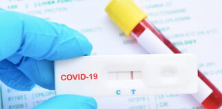 Understanding Covid Antibody Testing What You Need To Know In The USA