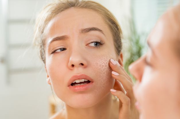 Get Healthy Skin How to Deal with Dry Skin