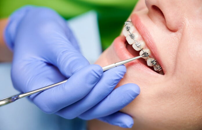 4 Dental Procedures To Enhance Your Smile