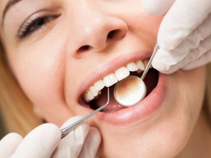 Keeping Your Teeth Sparkling: An Overview of Dental Cleaning Alternatives