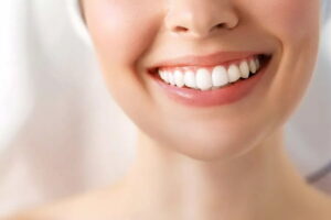 Cavity in Between Front Teeth: Causes, Prevention, and Treatment
