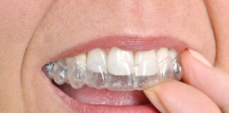Crafting Perfect Smiles with Invisalign