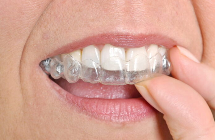 Crafting Perfect Smiles with Invisalign