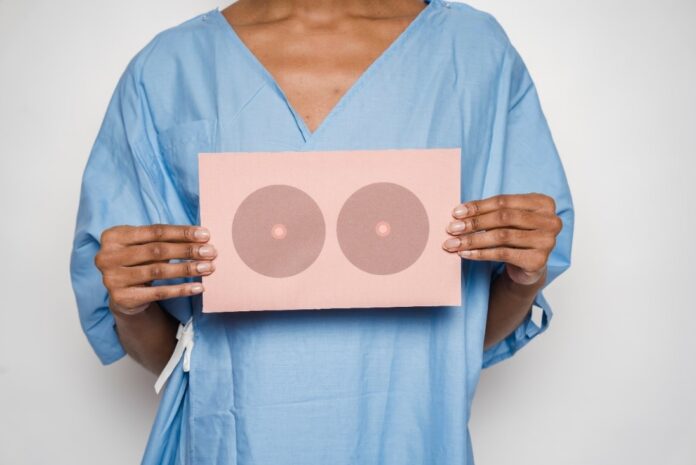 Eight Things You Should Know About a Breast Lift Surgery