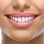5 Effective Ways to Cosmetically Enhance Your Smile