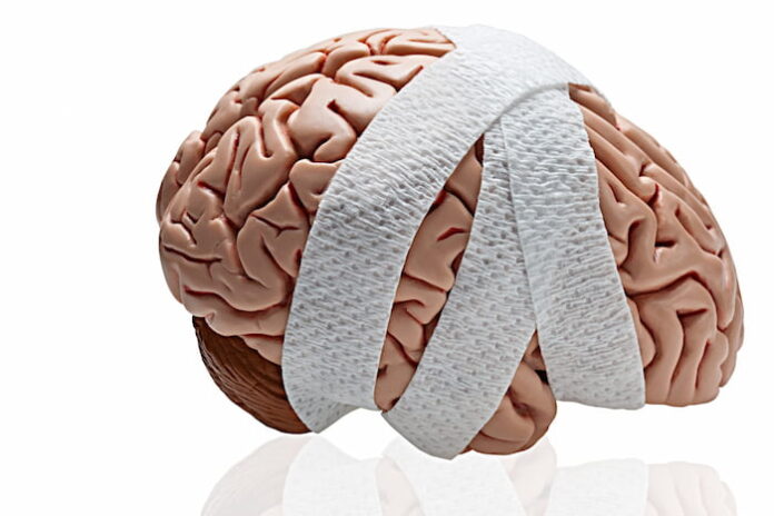 Traumatic Brain Injury 6 Major Causes in People and The Best Treatment Options