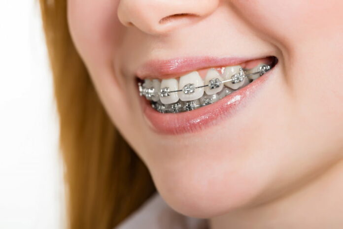 What To Look For In A Trusted Orthodontics Near You