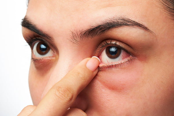 The Best Remedies for Waking Up with Dry Eyes in the Morning