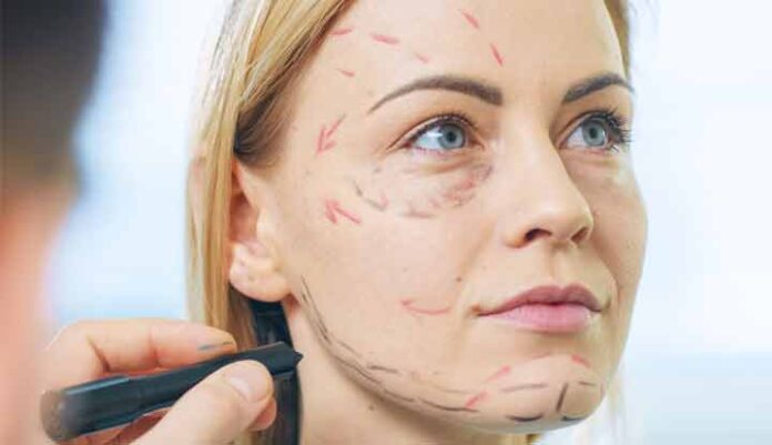 Everything you need to know about getting a facelift in 60 seconds