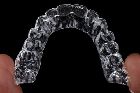Invisalign Treatment At Affordable Prices