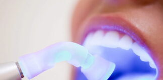 The Ultimate Guide to Teeth Whitening and Dental Bleaching