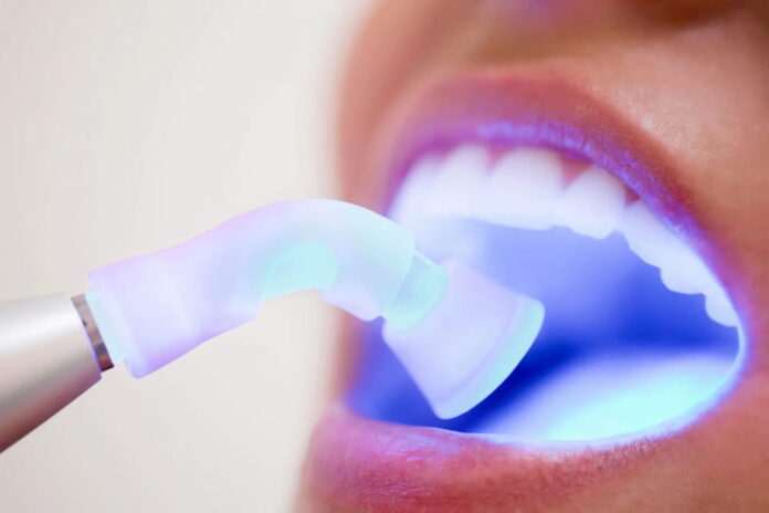 The Ultimate Guide to Teeth Whitening and Dental Bleaching The Ultimate Guide to Teeth Whitening and Dental Bleaching