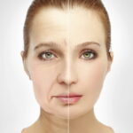 What is Enhanced Facial Fat Grafting?