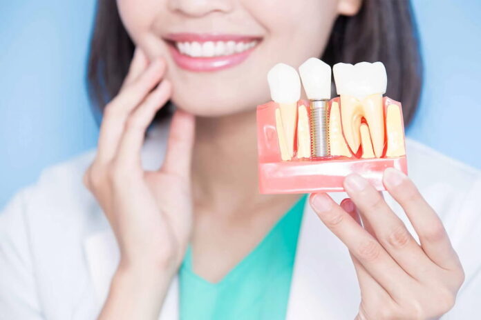 Five Reasons to Invest in Dental Implants to Replace Lost Teeth