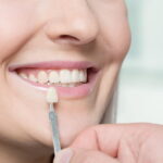 Understanding the Different Types of Tooth Caps, Coverings, and Veneers