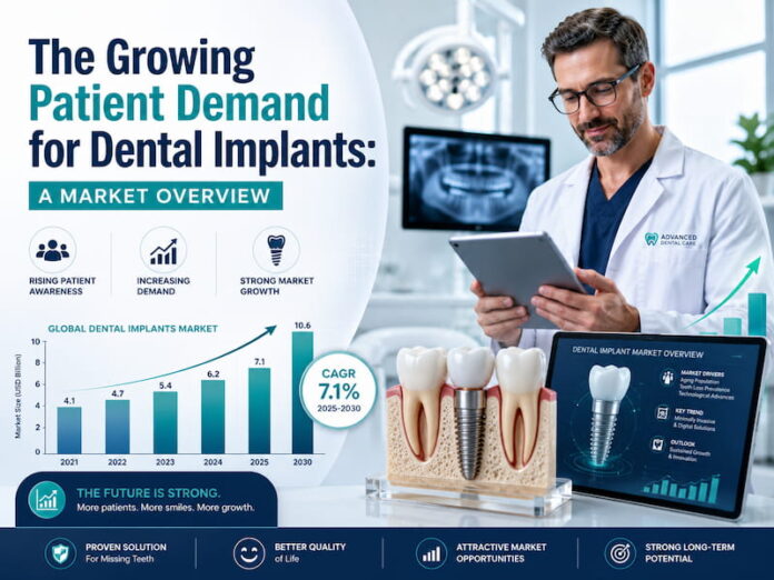 The Growing Patient Demand for Dental Implants A Market Overview