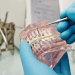 The Evolution of Dental Prosthetics