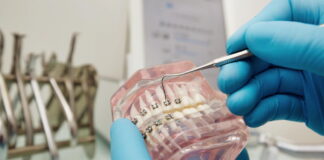 The Evolution of Dental Prosthetics